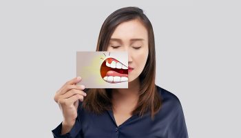 Gum Disease Explained: Causes, Symptoms, and Treatment Options