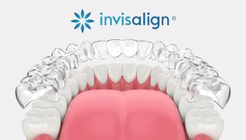 Invisalign vs. Braces: Which Is Right for You?